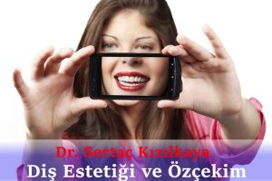 Ön diş estetiği istanbul